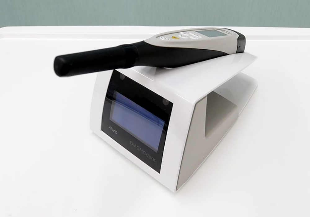 精密なむし歯診断装置「ダイアグノデント」